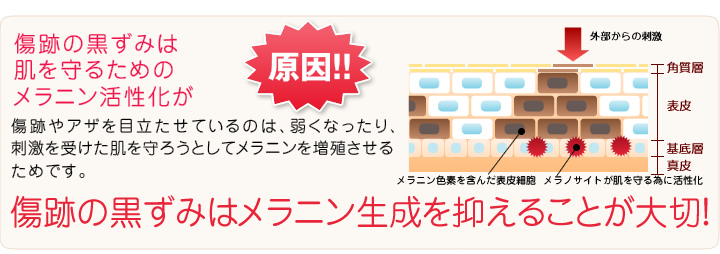 傷跡を消すにはメラニン生成を抑えることが肝心
