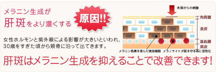 肝斑（かんぱん）は、メラニン生成を抑えることで改善できます
