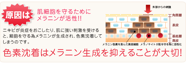 色素沈着はメラニン生成を抑えることが大切